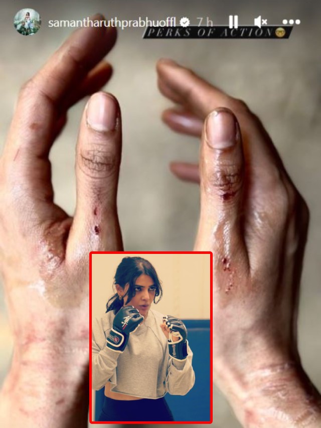 Heroine Samantha injured in the Shooting..