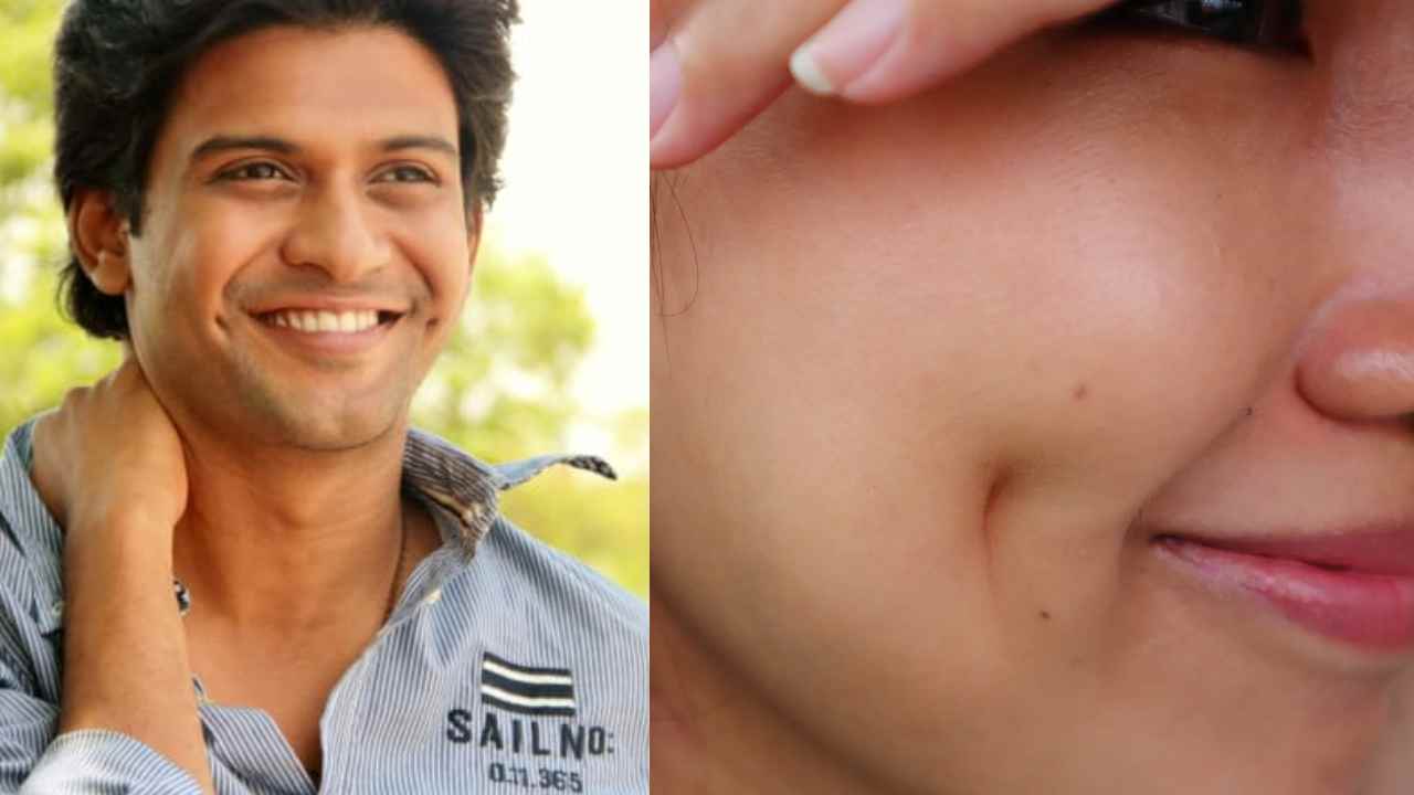 Dimples : బుగ్గలో సొట్ట ఉంటే బాగుండు అనుకుంటుంన్నారా?? కానీ అది ఎలా వస్తుందో తెలుసా?