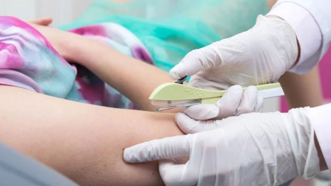 Contraception Method: గర్భనిరోధానికి కేంద్రం కొత్త పద్ధతి.. ముందుగా తెలుగు రాష్ట్రాలలో అమలు!