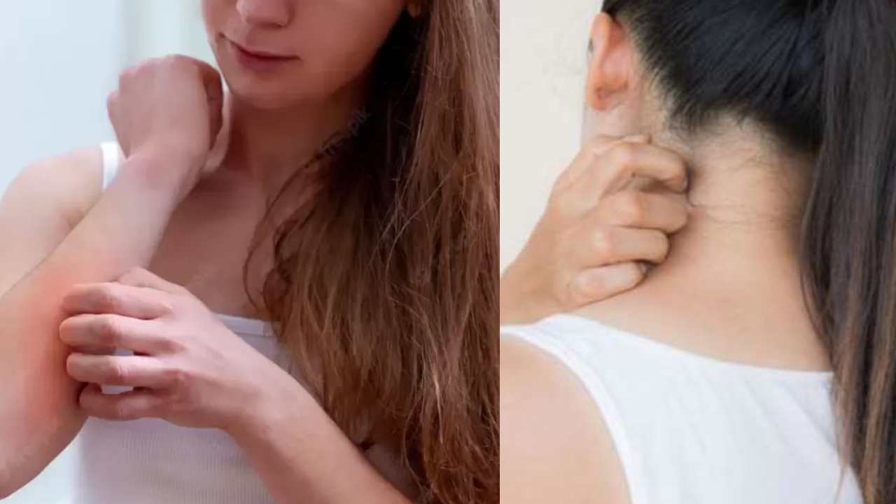 Itching Rashes : దురద, దద్దుర్లు ఎక్కువగా వస్తున్నాయా? ఈ చిట్కాలు పాటించండి..
