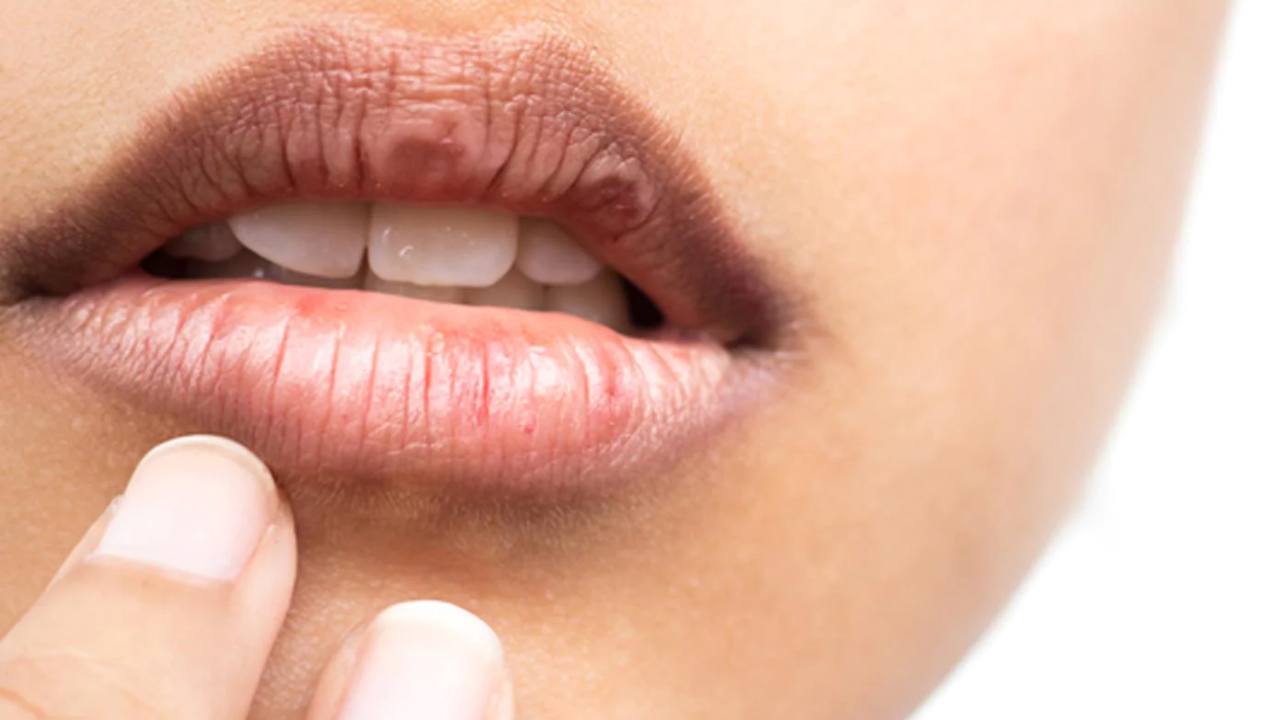 Lips Cracking : ఎండాకాలంలో పెదాలు పొడిబారుతున్నాయా.. అయితే ఈ చిట్కాలు పాటించండి..